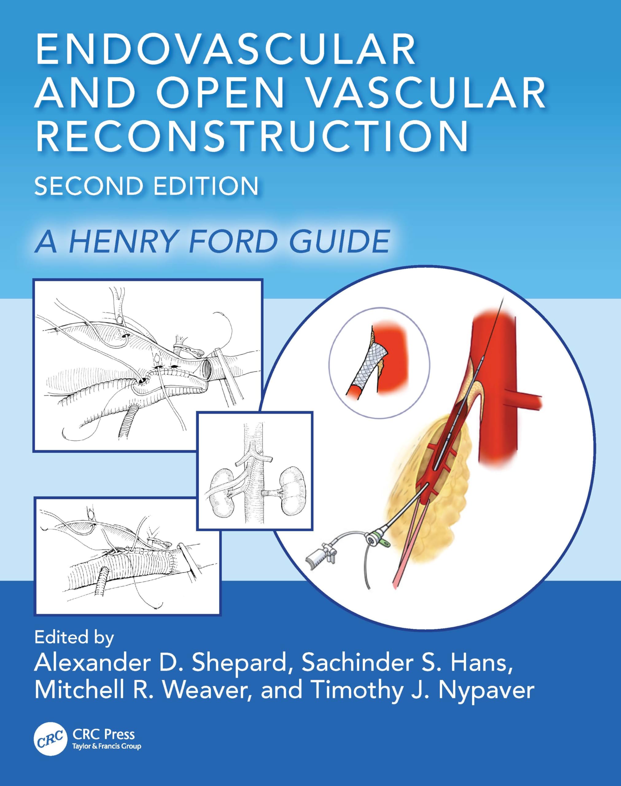 Endovascular and Open Vascular Reconstruction: A Henry Ford Surgical Guide |9781032433776|